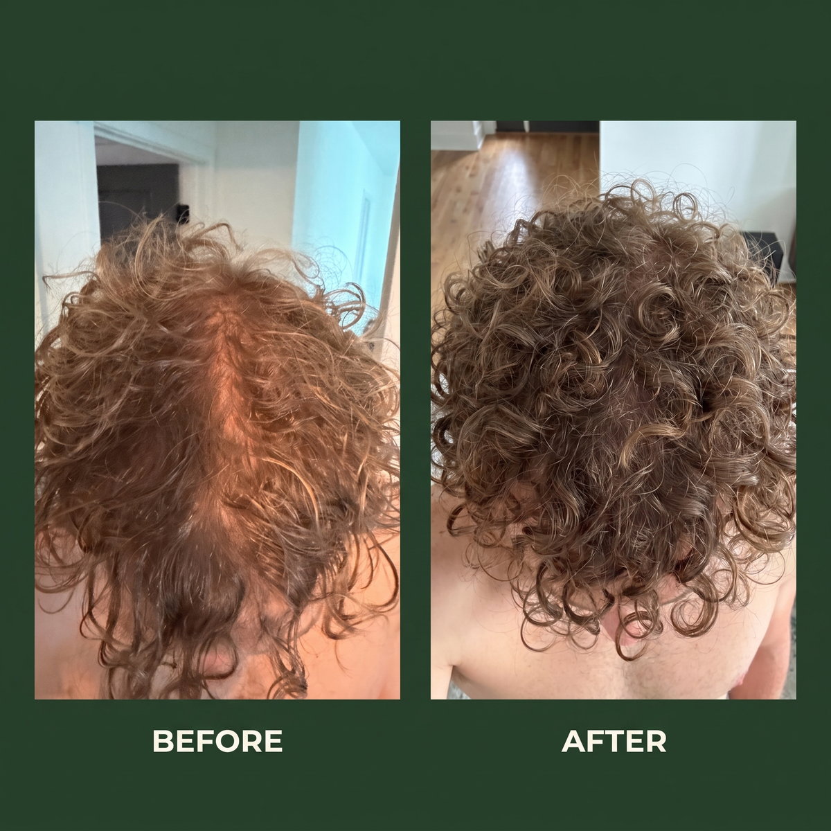 Scalp + Hair Treatment Bar
