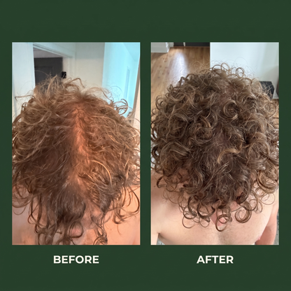 Scalp + Hair Treatment Bar